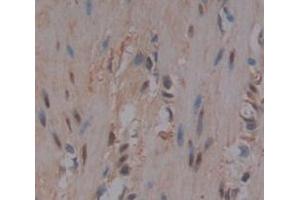 Used in DAB staining on fromalin fixed paraffin- embedded skeletal muscle tissue (FLII Antikörper  (AA 896-1176))