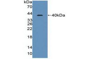 Figure. (IRF8 Antikörper  (AA 128-426))