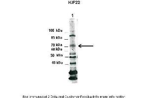 Lanes:   1. (KIF22 Antikörper  (N-Term))