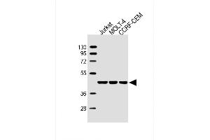 Lane 1: Jurkat, Lane 2: MOLT-4, Lane 3: CCRF-CEM cell lysate at 20 µg per lane, probed with bsm-51447M ADA (608CT2. (ADA Antikörper)