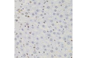 Immunohistochemistry of paraffin-embedded rat liver using AKAP8 antibody (ABIN5975842) (40x lens). (AKAP8 Antikörper)