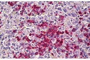 Anti-CDH23 antibody IHC staining of human spleen. (CDH23 Antikörper  (AA 61-110))