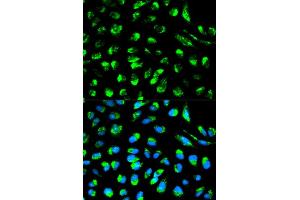 Immunofluorescence analysis of HeLa cells using ECI1 antibody (ABIN5970553). (DCI Antikörper)