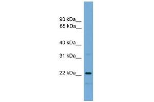 WB Suggested Anti-C9orf95 Antibody Titration: 0.