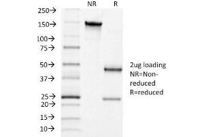 SDS-PAGE Analysis Purified LHCGR Mouse Monoclonal Antibody (LHCGR/1415). (LHCGR Antikörper  (AA 70-410))