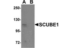 Western blot analysis of SCUBE1 in Daudi cell lysate with SCUBE1 antibody at 1 μg/ml in (A) the absence and (B) the presence of blocking peptide. (SCUBE1 Antikörper  (Center))