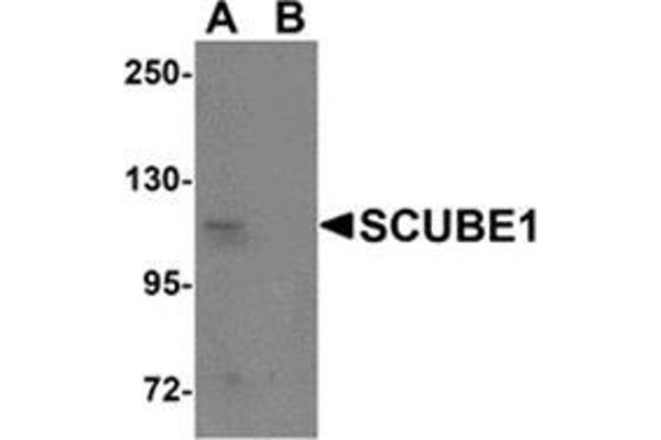 SCUBE1 antibody  (Center)