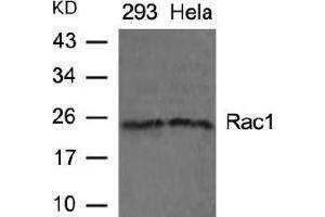 Image no. 2 for anti-RAC1 (AA 69-73) antibody (ABIN197429) (RAC1 Antikörper  (AA 69-73))