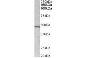 AP31711PU-N (1µg/ml) staining of Daudi lysate (35µg protein in RIPA buffer). (Chitotriosidase 1 Antikörper  (Internal Region))