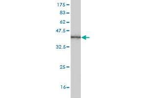 Western Blot detection against Immunogen (36. (GRHL3 Antikörper  (AA 101-200))