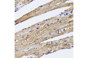 Immunohistochemistry of paraffin-embedded rat heart using MAP1LC3B antibody (ABIN5974331) at dilution of 1/100 (40x lens).