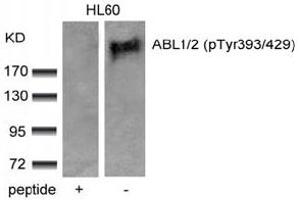 Image no. 3 for anti-Abelson Murine Leukemia Viral Oncogene Homolog 1/2 (ABL1/ABL2) (pTyr393), (pTyr439) antibody (ABIN319285) (ABL1/2 Antikörper  (pTyr393, pTyr439))