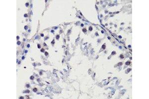 Immunohistochemistry of paraffin-embedded Rat testis using p27 KIP 1 Polyclonal Antibody at dilution of 1:100 (40x lens). (CDKN1B Antikörper)