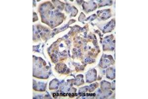 BTBD17 Antibody (C-term) immunohistochemistry analysis in formalin fixed and paraffin embedded human pancreas tissue followed by peroxidase conjugation of the secondary antibody and DAB staining. (BTBD17 Antikörper  (C-Term))