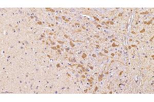 Immunohistochemistry (IHC) image for anti-Tyrosine Hydroxylase (TH) (AA 82-310) antibody (ABIN7433633)