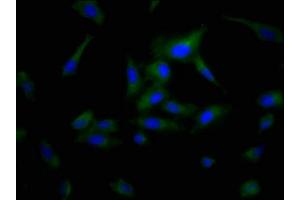 Immunofluorescence staining of Hela cells with ABIN7163899 at 1:200, counter-stained with DAPI. (POPDC3 Antikörper  (AA 130-291))