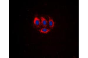 Immunofluorescent analysis of BMX (pY566) staining in HeLa cells. (BMX Antikörper  (C-Term, pTyr566))