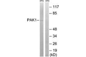 Western Blotting (WB) image for anti-P21-Activated Kinase 1 (PAK1) (AA 170-219) antibody (ABIN2889112) (PAK1 Antikörper  (AA 170-219))