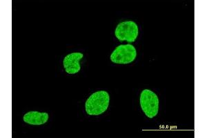 Immunofluorescence of monoclonal antibody to VPS8 on HeLa cell. (VPS8 Antikörper  (AA 1329-1428))