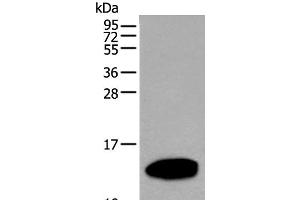 Western blot analysis of Human pancreas tissue lysate using REG1A Polyclonal Antibody at dilution of 1:500 (REG1A Antikörper)