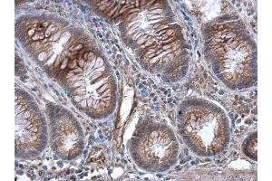 IHC-P Image GBP3 antibody [N1C1] detects GBP3 protein at cytoplasm in human colon by immunohistochemical analysis. (GBP3 Antikörper)