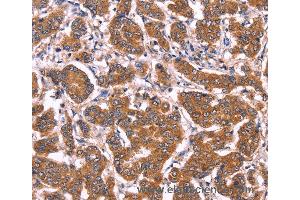 Immunohistochemistry of Human tonsil using COL20A1 Polyclonal Antibody at dilution of 1:40 (COL20A1 Antikörper)