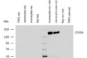 Western blotting analysis of human CD206 using mouse monoclonal antibody 15-2 on lysates of differentiated monocytes (two batches), and on THP-1 and Raji cells (negative controls) under reducing and non-reducing conditions. (Macrophage Mannose Receptor 1 Antikörper)