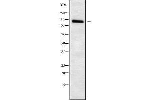 Western blot analysis SLC4A7 using HuvEc whole cell lysates (SLC4A7 Antikörper  (Internal Region))