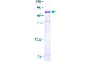 ERP44 Protein (AA 30-406) (GST tag)