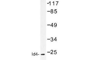 Image no. 1 for anti-Inhibitor of DNA Binding 4, Dominant Negative Helix-Loop-Helix Protein (ID4) antibody (ABIN317715) (ID4 Antikörper)