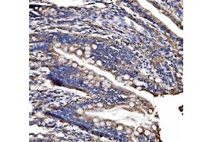 IHC analysis of CPS1 using anti-CPS1 antibody (ABIN7599871). (CPS1 Antikörper  (AA 124-379))