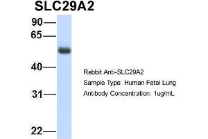 Host: Rabbit Target Name: SLC29A2 Sample Type: Human Fetal Lung Antibody Dilution: 1. (SLC29A2 Antikörper  (C-Term))
