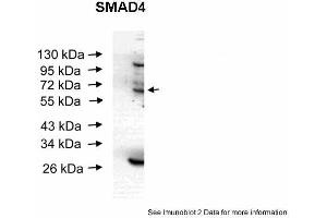 Western Blotting (WB) image for anti-SMAD Family Member 4 (SMAD4) (Middle Region) antibody (ABIN2779413) (SMAD4 Antikörper  (Middle Region))