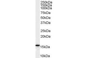 Western Blotting (WB) image for anti-DKFZp686P1551 (C-Term) antibody (ABIN2785710) (DKFZp686P1551 (C-Term) Antikörper)