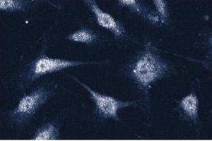 Immunofluorescence staining of human endothelial cells.
