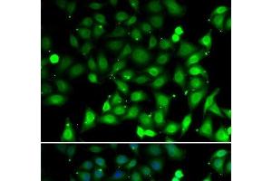 Immunofluorescence analysis of MCF-7 cells using RAE1 Polyclonal Antibody (RAE1 Antikörper)