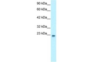 Western Blotting (WB) image for anti-General Transcription Factor IIF, Polypeptide 2, 30kDa (GTF2F2) antibody (ABIN2460222) (GTF2F2 Antikörper)