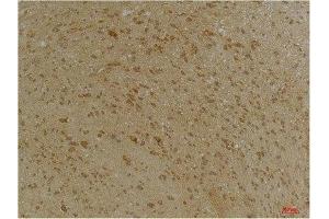 Immunohistochemistry (IHC) analysis of paraffin-embedded Mouse Brain Tissue using SLC12A4 Rabbit Polyclonal Antibody diluted at 1:200. (SLC12A4 Antikörper)