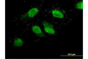 Immunofluorescence of monoclonal antibody to LOC220594 on HeLa cell. (LOC220594 (AA 255-354) Antikörper)