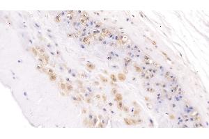 Detection of NOG in Human Placenta Tissue using Polyclonal Antibody to Noggin (NOG) (NOG Antikörper  (AA 28-232))