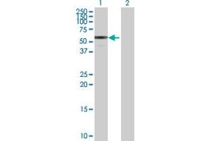 Western Blot analysis of ENTPD3 expression in transfected 293T cell line by ENTPD3 MaxPab polyclonal antibody.