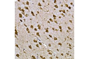 Immunohistochemistry of paraffin-embedded mouse brain using CPEB3 Rabbit pAb (ABIN7266666) at dilution of 1:300 (40x lens). (CPEB3 Antikörper  (AA 150-400))