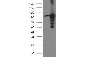 Western Blotting (WB) image for anti-Protein Kinase C, epsilon (PRKCE) antibody (ABIN1500235) (PKC epsilon Antikörper)