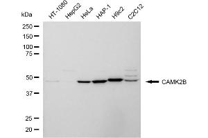 Western blotting analysis using CAMK2B antibody (ABIN7797834).