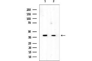 anti-Chromosome 22 Open Reading Frame 9 (C22orf9) antibody