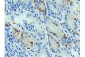 DAB staining on IHC-P; Samples: Human Stomach Tissue (BMP4 Antikörper  (AA 293-408))