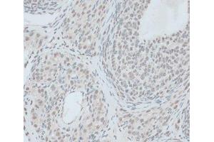 Immunohistochemistry of paraffin-embedded Rat ovary using ZNF416 Polyclonal Antibody at dilution of 1:100 (40x lens). (ZNF416 Antikörper)