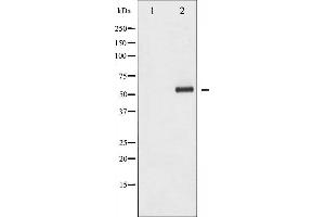 Western blot analysis of HDAC1 phosphorylation expression in EGF treated Jurkat whole cell lysates,The lane on the left is treated with the antigen-specific peptide.