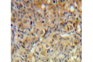 Used in DAB staining on fromalin fixed paraffin-embedded Ovary tissue (PIK3C2A Antikörper  (AA 172-403))