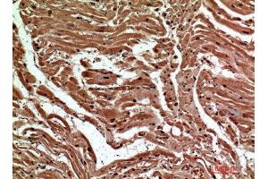 Immunohistochemistry (IHC) analysis of paraffin-embedded Human Heart, antibody was diluted at 1:200. (C-Type Lectin Domain Family 6, Member A (CLEC6A) Antikörper)